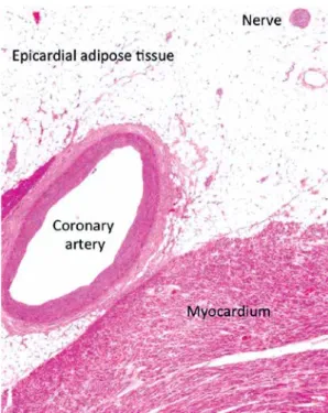 Figure 4. Microscopic view of the epicardial adi- adi-pose tissue. It is of note that there is no  separat-ing fascia layer between the epicardial fat and the  myocardium