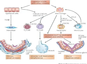Figure 2: Inflammatory processes in COPD 1