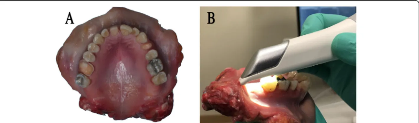 Fig. 1 a Cadaver maxilla with teeth (tooth #3, #8, #12) prepared for a crown, b Scanning initiated at the scanning origin (tooth #15)