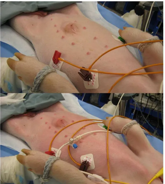 Figure  9:  Skin  reaction  during  CARPA.Above:  normal  skin  before  injection  Below: 