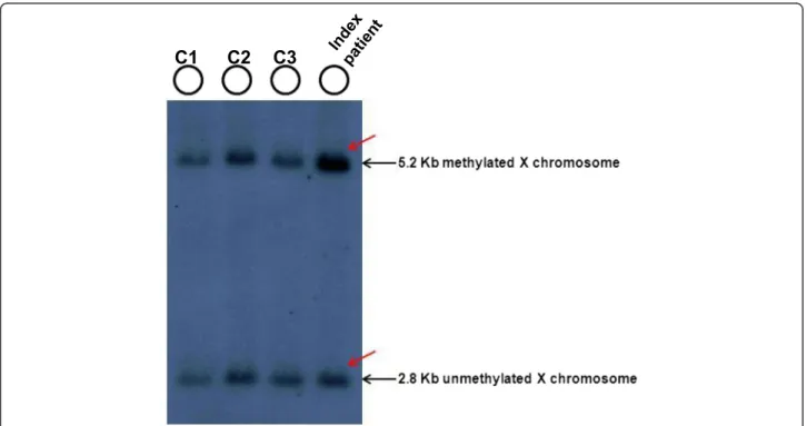 Fig. 2 Southern blot analysis of the patient and of control females. EcoRI and EagI double digested DNA samples hybridized with radioactive-labelled Stb12.3 probe were used for Southern blot analysis