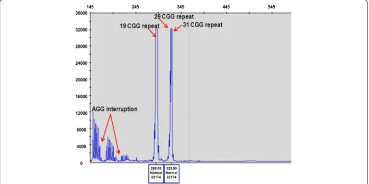 Fig. 3 Repeat-Primed PCR analysis. Repeat-primed PCR analysis revealed three peaks corresponding to a 19, 29 and 31CGG repeat representing three FMR1 gene alleles (red arrow)