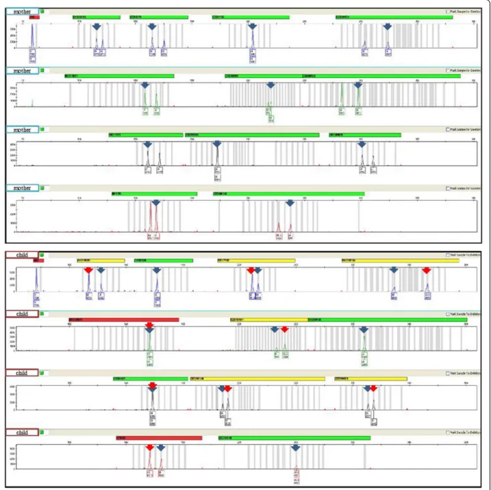 Fig. 5 X chromosomal genotypes of the mother and the patient. The Investigator Argus X-12 kit contains 12 X-chromosomal STR loci located on both arms of the X chromosome