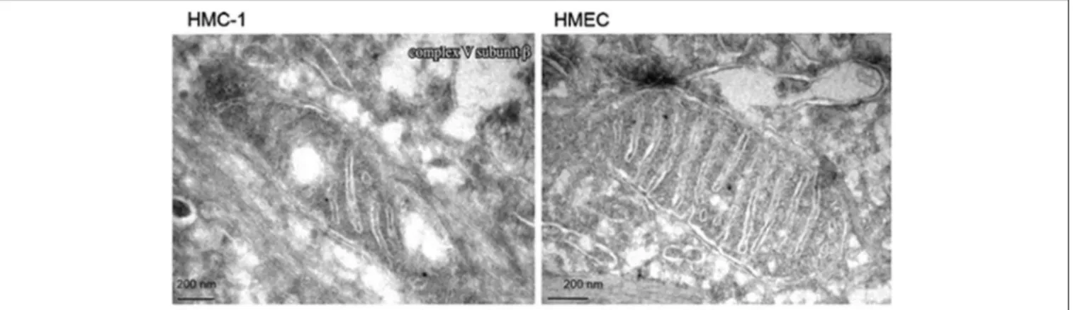 FIGURE 1 | Electron microscopy of primary breast cancer cells (human mammary carcinoma HMC-1) and human epithelial mammary cell control line (HEMC).