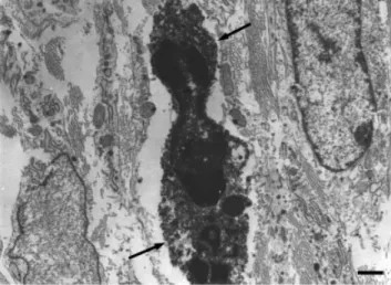 Fig. 10. Electron microscopic photograph of a TNF- a –IR mast cell from the gastritis