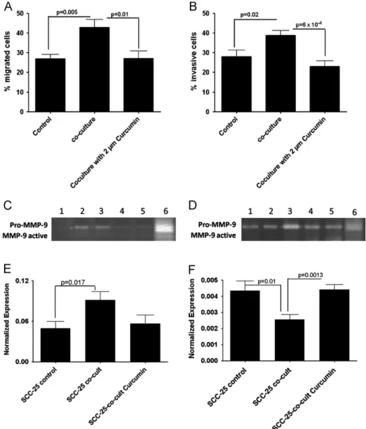 Fig. 2 – Effects of Curcumin on the invasivity and EMT of SCC-25 cells in co-culture. After 4 days of normal or Curcumin-treated co-culture (PDL ﬁbroblasts with SCC-25 cells): migration (A) and invasivity (B) of SCC-25 cells was determined as described in 