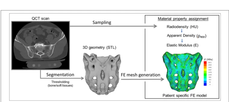FIGURE 2 | Patient-specific geometry and FE model definition. QCT based segmentation was used to define the sacrum geometry