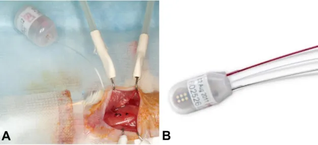 Figure 4. TA11PA-C10 and HDX-11 telemetry blood pressure monitoring device. (A) The  TA11PA-C10 telemetric blood pressure monitoring device  with left carotid artery cannulation  in  mice