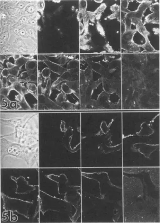 Figure 5. Confocal laserscanning microscopy ofadherentbhuman melanoma cells labeled for intracellular membrane-type HSPG epitopes