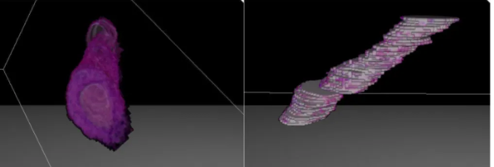 3. Ábra. 3D rekonstruált érszakaszban a neointima és a lumen megjelenítése. A-minta.