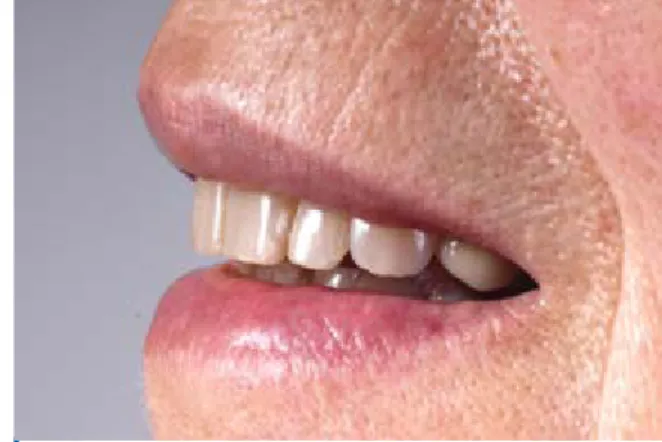 Figure 16. Smile of the patient