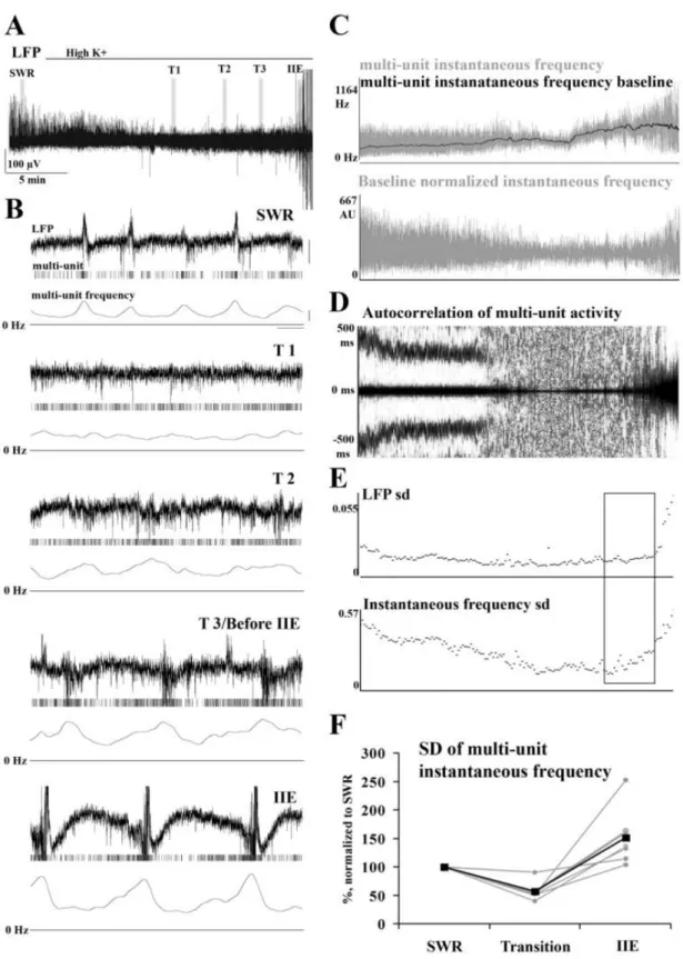 Figure 10. Reorganization of synchrony higk K +  model od epilepsy. A: Local field potential (LFP) during  the transitory phase in the presence of 8.5 mM K + 