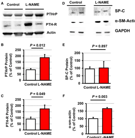 Fig. 4 Effect of L-NAME administration on the pulmonary protein expression of PTHrP, PTH-1 receptor (PTH-R),  surfac-tant protein C (SP-C), and a -smooth  mus-cle actin