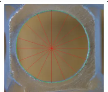 Fig. 2 The figure shows how the stereomicroscopy examination was done. The dimensions of the hole was recorded