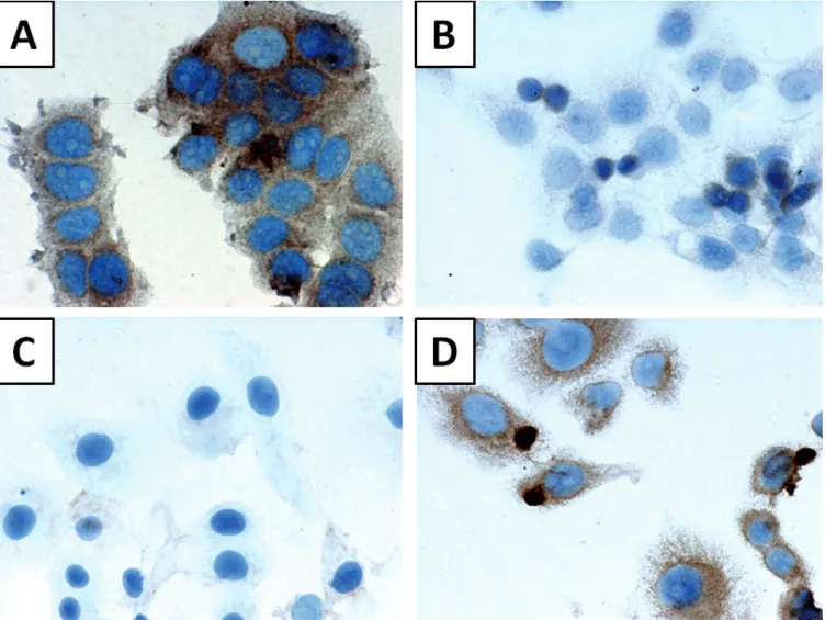 Fig. 6. Immunocytochemical location of S100P expression in cells of: MCF-7 breast cancer cell line (A), CAMA-1 breast cancer cell line (B), SK-BR-3 breast cancer cell line (C) and R-103 breast cancer cell line (D).
