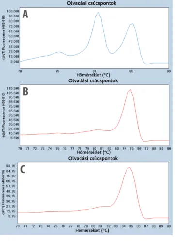 1. ábra Az  SNRPN locus HRM-vizsgálat során detektált metilációs  görbéi. A: Két olvadási csúcs (nem metilált apai: Tm = 80,63 ±  0,24 °C, metilált anyai: Tm = 84,97 ± 0,35 °C) detektálható  egészséges emberekben