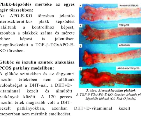 3. ábra: Ateroszklerotikus plakkok   A TGF- -TGxAPO-E-KO törzsben jelentős plakk 