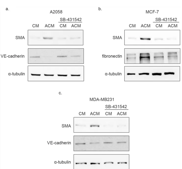 Fig 4. Activated cancer cell conditioned medium induces SMA expression through TGF- β signaling in RBECs