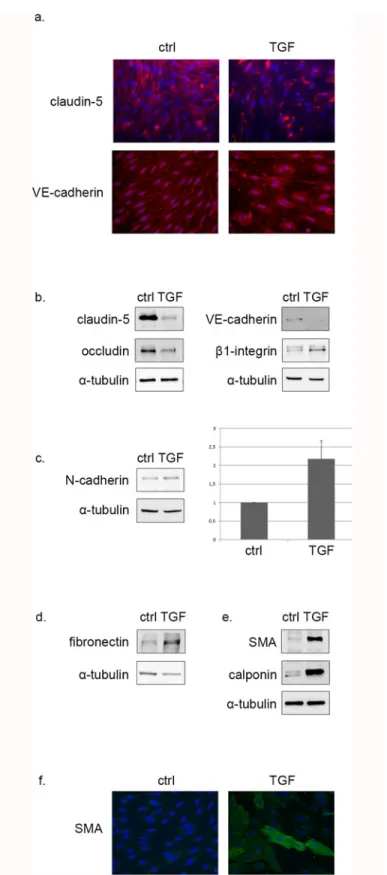 Fig 1. TGF- β 1 induces EndMT in primary rat BECs. (a) BECs were subjected to 48 hrs TGF- β 1 treatment, then fixed and stained for claudin-5 and VE-cadherin