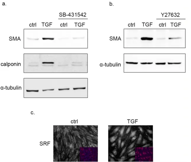 Fig 2. TGF- β 1 induced SMA expression in BECs requires TGF β R and ROCK. TGF- β 1 treatment leads to SRF nuclear translocation