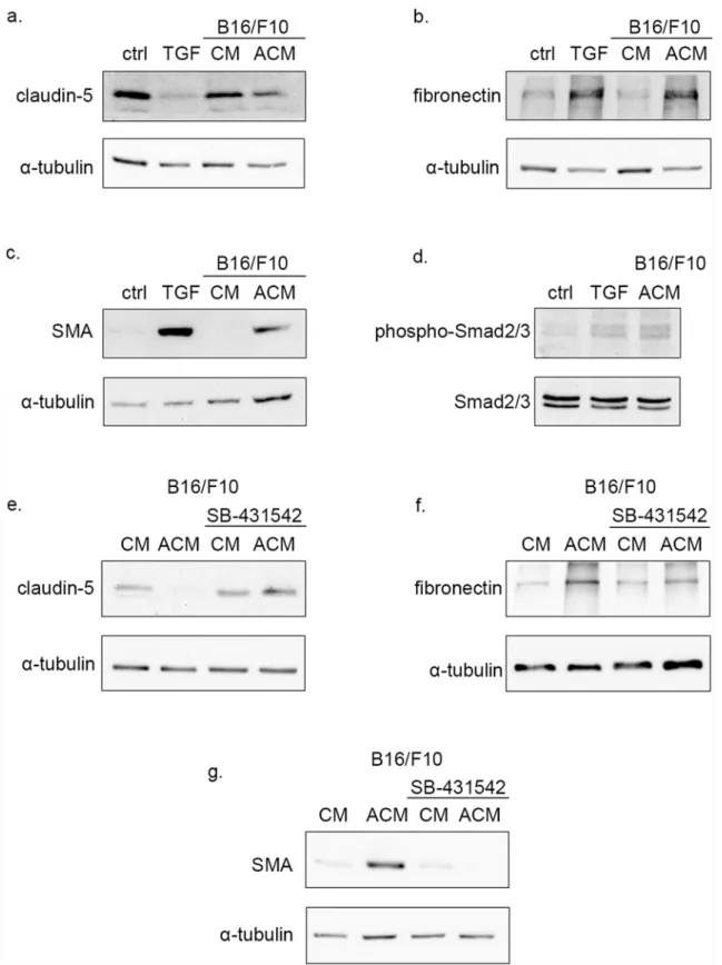 Fig 3. Activated B16/F10 conditioned medium induces EndMT in BECs through TGF- β signaling