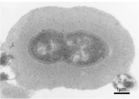 Figure 3. Immunoelectron microscopy of pneumococcal capsules showing an increased  zone of capsular material in serotype 6B (20)