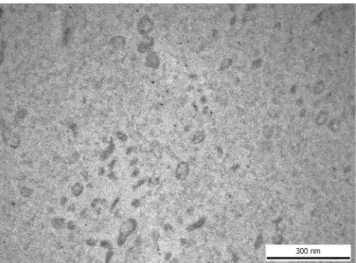 Figure 1.  Transmission electron microscopic image of human blood plasma EVs isolated by  ultracentrifugation, washed once and submitted to RNAse digestion.