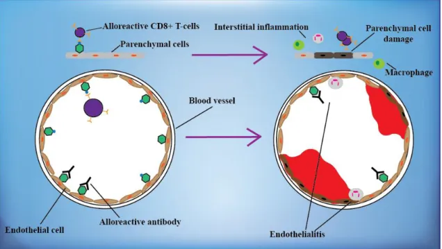 Figure  6.  Acute  allograft  rejection.  In  cellular  forms  of  acute  rejection,  CD8+  T- T-lymphocytes  recognize  alloantigens  on  the  endothelial  and  parenchymal  cells  of  the  graft  and  cause  their  damage  (upper  part),  whereas  in  hu