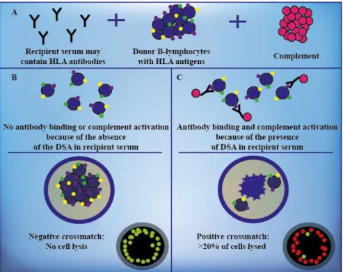 Figure 11. The CDC B-cell crossmatch assay. Recipient serum potentially containing  DSA is added to donor B-lymphocytes in the presence of complement (A)