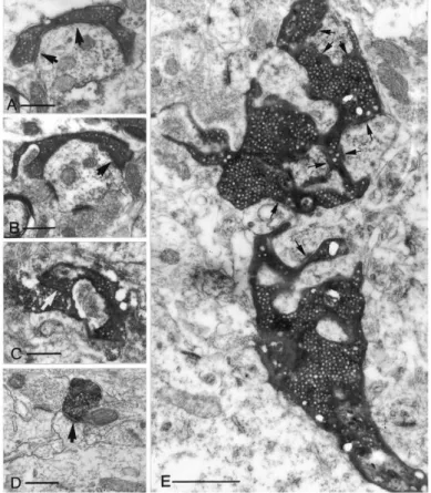 Figure 4. Comparison of the different MF terminal types on electron microscopic level