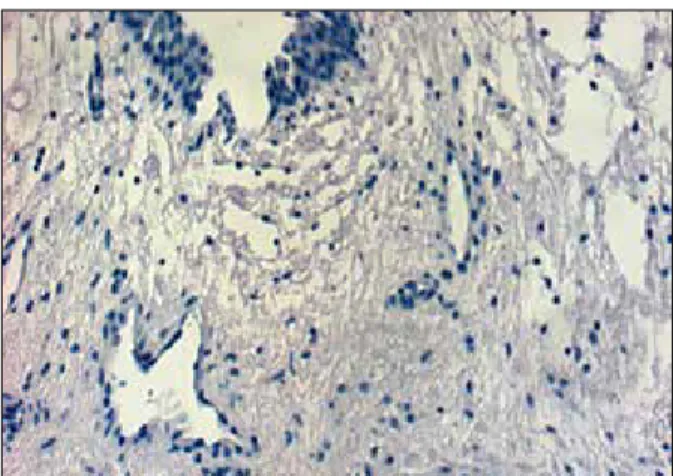 Figure 3.  Subserosa in a fetal ureteropelvic tissue. The slide has  no positive cells in the fetal tissue (without urinary  obstruction).