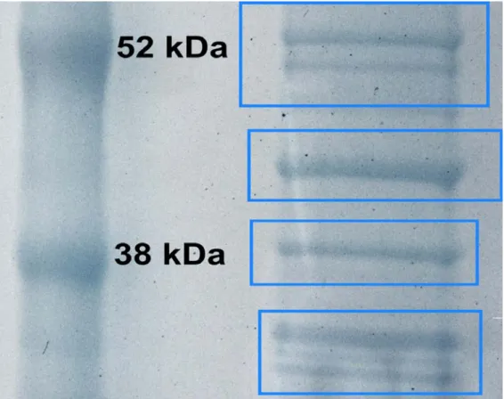 5. ábra Jurkat T-sejt eredet ű extracelluláris vezikulum gélelektroferogramja  (baloldalon a molekulasúly markerekkel)