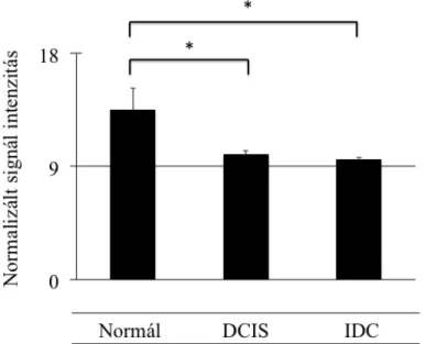 14. ábra: SCAI gén expresszió összehasonlítása emlő daganat expressziós adatbázisból  (GDS3853)  származó  adatokból:  egészséges  emlőszövet  (n=5),  in  situ  duktális  carcinoma  (DCIS,  n=9),  és  duktális  típusú  invazív  emlőkarcinóma  (IDC,  n=5)