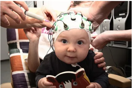 Figure 5.4.1. Young patients with an EEG cap before the experimental condition on the lap of his mother.