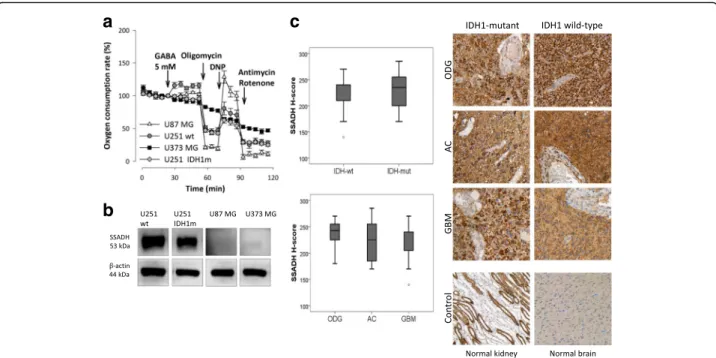 Fig. 5 GABA oxidation and SSADH expression differences in glioma cell lines; and common SSADH expression in human glioblastoma/glioma samples