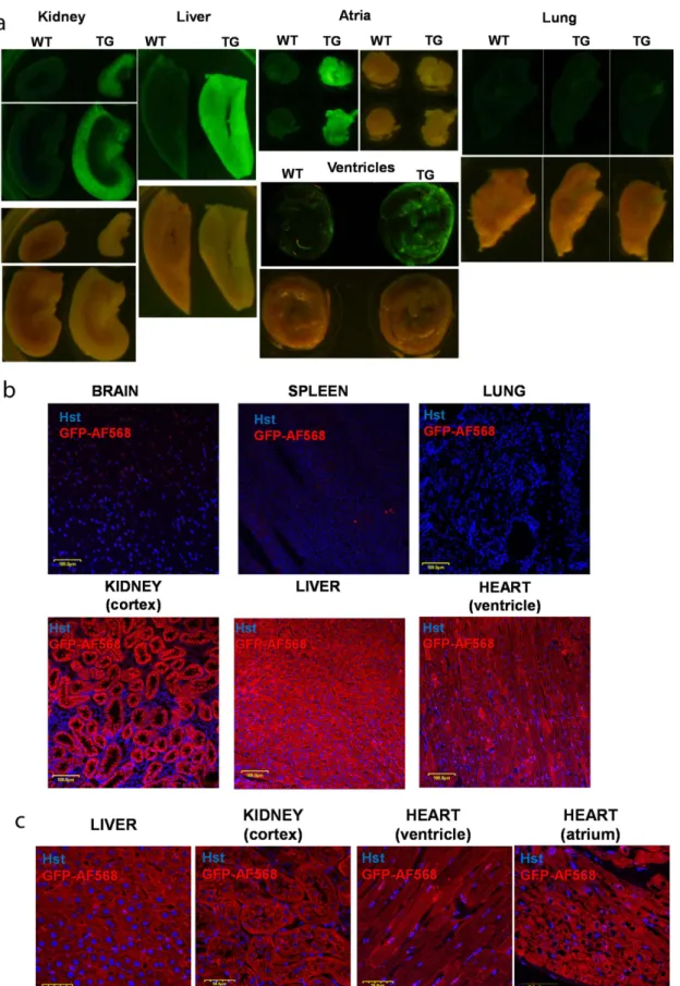 Figure 2.  Expression of the GCaMP2 calcium sensor in transgenic rats. (A) Fluorescence (upper) and  bright field (lower) images of wild type (WT) and transgenic (TG) kidney, liver, heart atria, ventricles and  lung