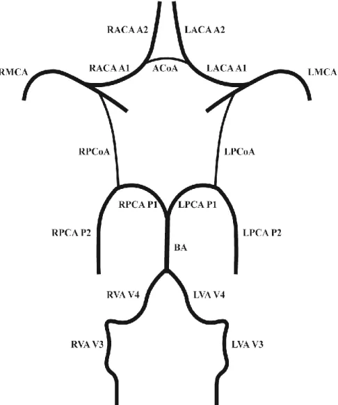 Figure 1. Normal anatomy of the CoW. ACoA: anterior communicating artery, LACA  A1: left anterior cerebral artery A1 segment, CoW: Circle of Willis, LACA A2: left  anterior cerebral artery A2 segment, LMCA: left middle cerebral artery, LPCA P1: left 