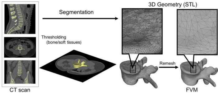 Fig. 1. Definition of virtual 3D geometry from 2D medical images. During the segmentation process the bone volume is first separated from the surrounding soft tissue by thresholding of the greyscale levels of the CT images