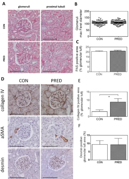 Figure 5. Kidney histology and immunohistochemistry. (A) Representative images of periodic-acid- periodic-acid-Schiff (PAS) stained glomeruli (left) and proximal tubuli (right) in CON (above) and PRED rats  (below)