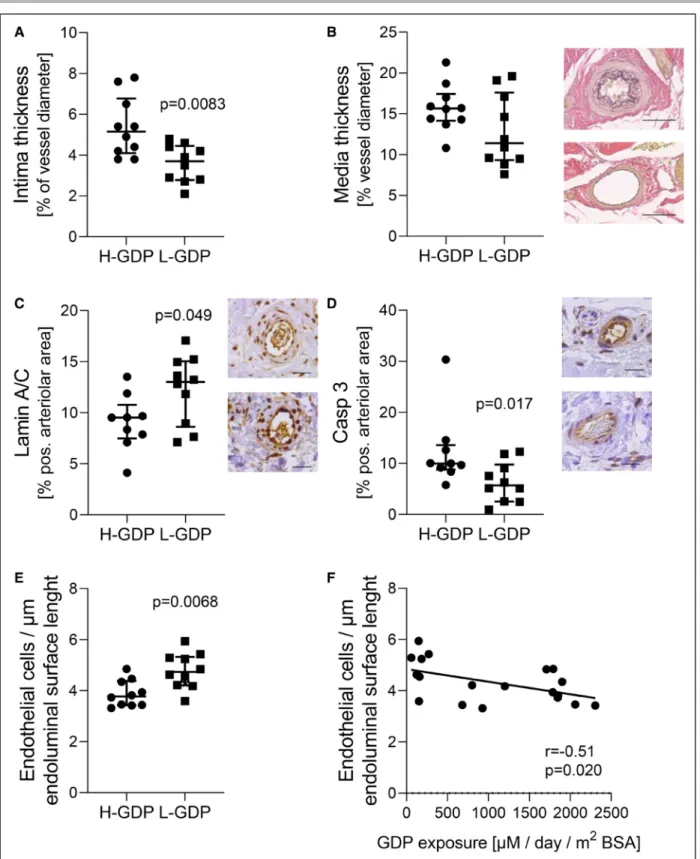 Figure 4. Arteriolar lumen narrowing and induction of arteriolar cell death pathways with high–glucose degradation products  (H-GDP) peritoneal dialysis (PD).