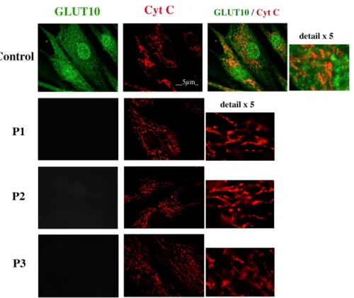 Figure 2. GLUT10 and mitochondrial immunostaining in fibroblasts from human healthy subjects  and three arterial tortuosity syndrome (ATS) patients