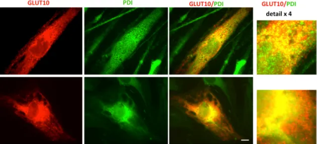 Figure 4. GLUT10 co-localizes with the ER marker protein disulfide isomerase (PDI). Tagged  GLUT10 was transiently transfected in fibroblasts of the ATS patient P1 that were immunoreacted  with antibodies to the GLUT10 tag and the ER marker PDI as reported