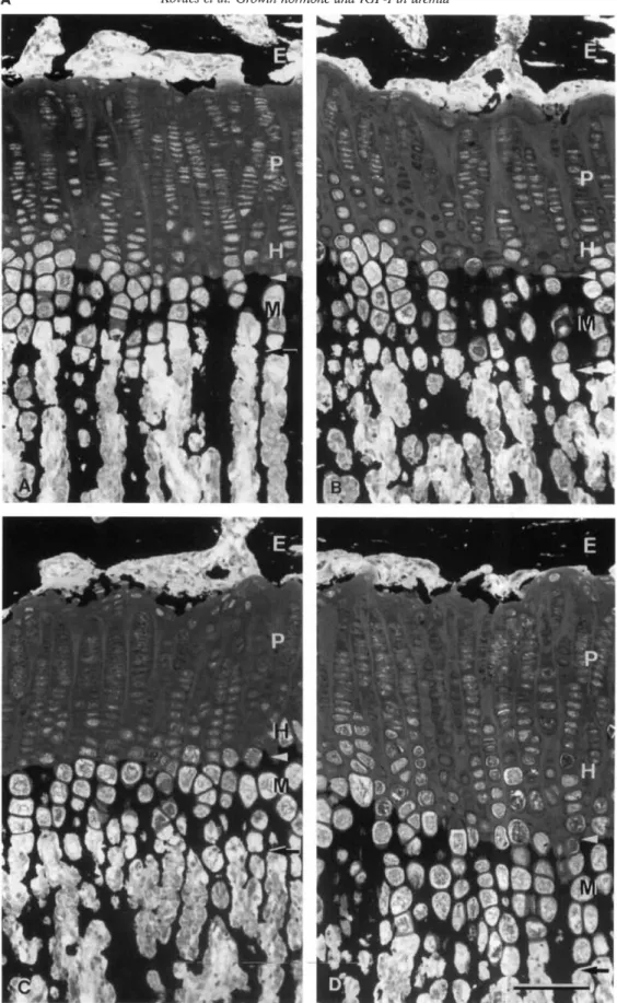 Fig. 3. A. Light micrographs of proximal tibial growth plate. Thick sections (5 jtm) of methylmetacrylate embedded proximal tibia! growth plate
