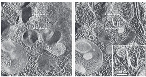 Fig. 5C). 6,25,93-96,103,104 Autolysosomes are delimited by a single
