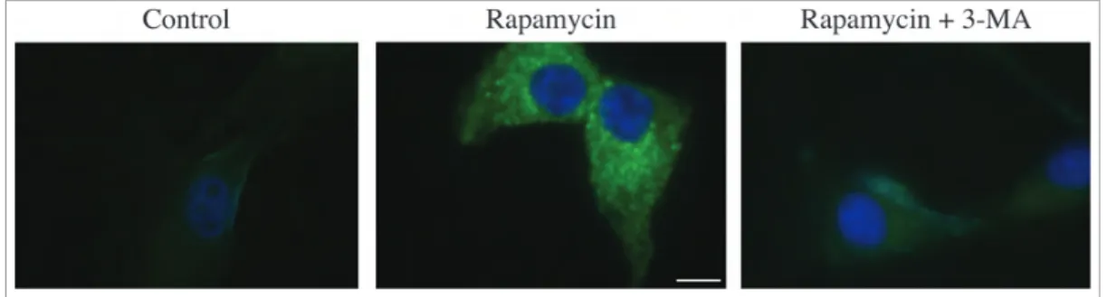 Figure 10. Changes in the detection and localization of GFP-LC3 upon the induction of autophagy