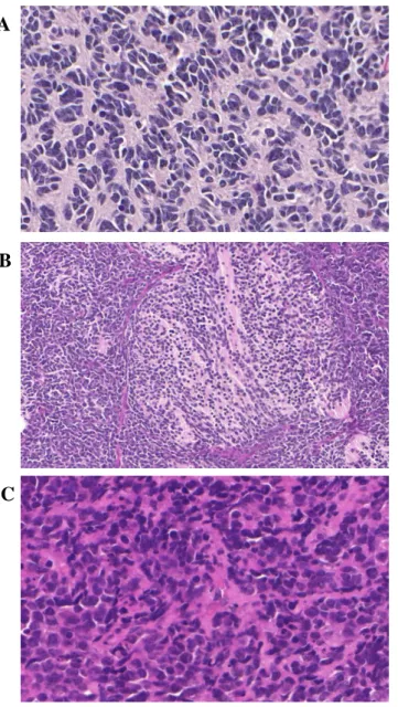 4. ábra: A medulloblastoma különböző szövettani megjelenése 