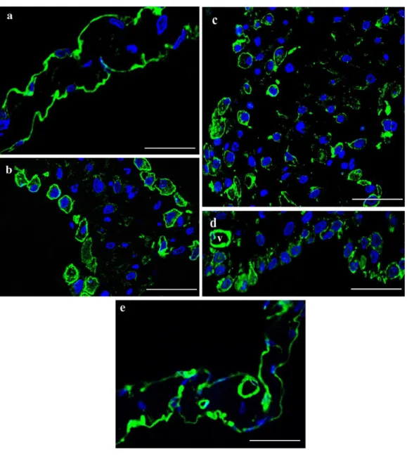 16. ábra: Caveolin-1 expresszió változása  a  mesothel sejtekben a gyulladás  során:  (a)  A  kontroll  mesothel  sejtekben  erős  caveolin-1  pozitivitás  figyelhető  meg  (zöld), de a pontos intracelluláris megoszlás a sejtek lapos morfológiájából adódóa