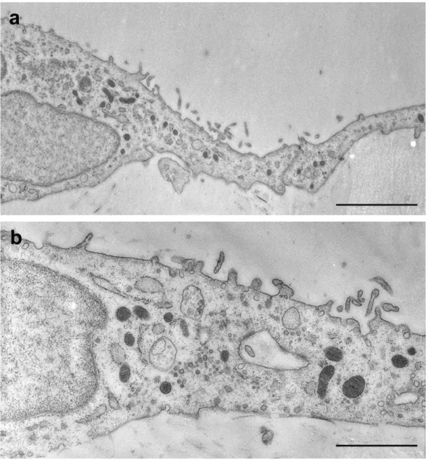 24. ábra: Adalékok nélküli DMEM/F12 tenyésztői médiumban három napig  inkubált  in  vitro  mezentérium  kultúra  mesothel  sejtjeinek  elektronmikroszkópos  felvételei: (a-b) A lapos mesothel sejtekben néhány mitokondrium, szekréciós vakuolum,  multiveziku