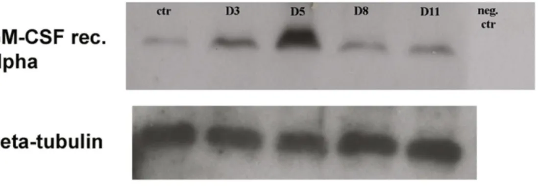33. ábra: GM-CSFR-α (50 kDa) kimutatása a mesothel sejtek lizátumából a  gyulladás különböző időpontjaiban: A kezeletlen állatokból származó mesothel sejtek  is expresszálják a receptort, amely a gyulladás előrehaladtával fokozódik, csúcspontját az  5