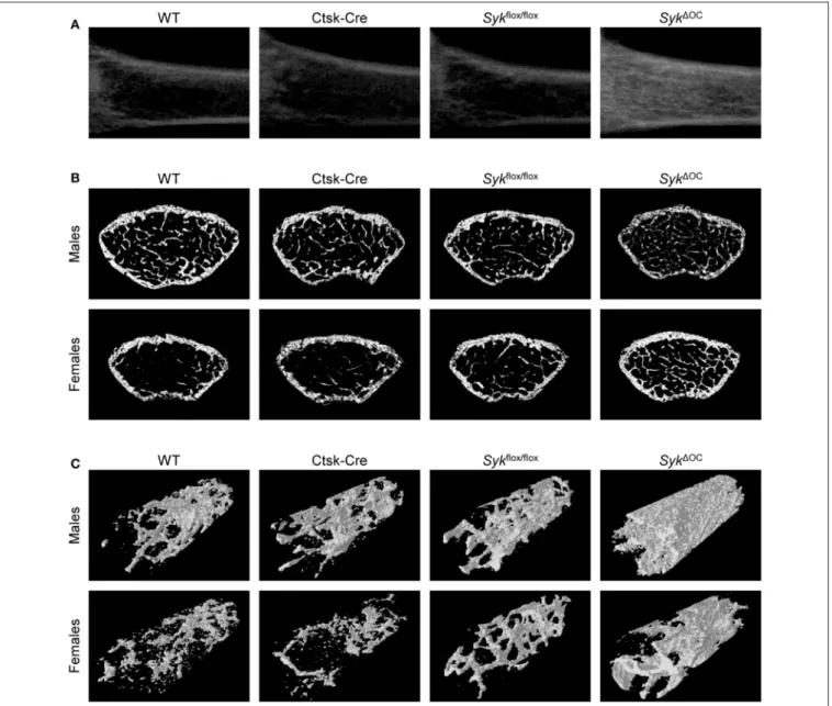 FIGURE 1 | Micro-CT analysis of osteoclast-specific Syk-deficient mice. Representative micro-CT images of the femurs of 9-week-old mice of wild type (WT) and the indicated mutant mice